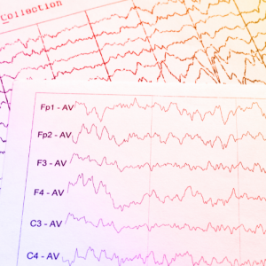 Eeg_Graphic_Biotrial